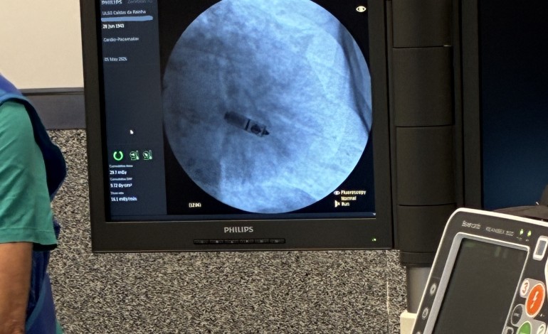 hospital-de-caldas-da-rainha-inicia-pratica-de-implantacao-de-pacemakers